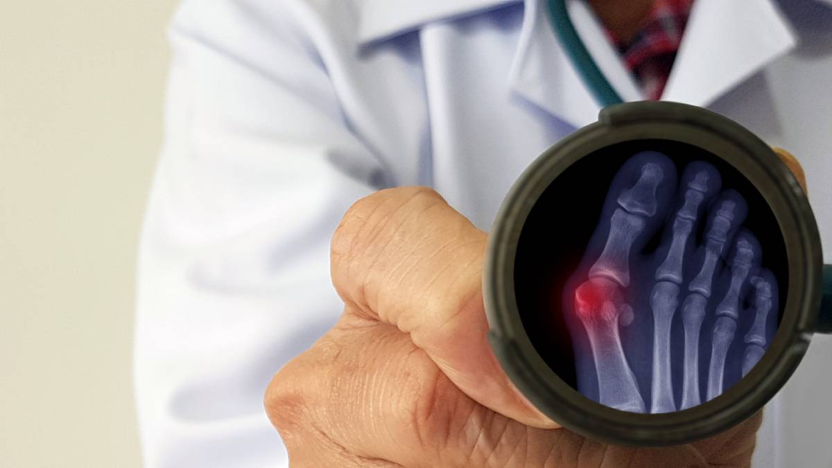 Stock image of a doctor showing bunions leg xray