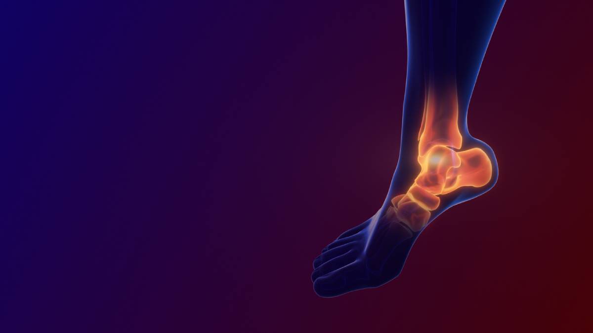 Image of Ankle Injury With Dislocation