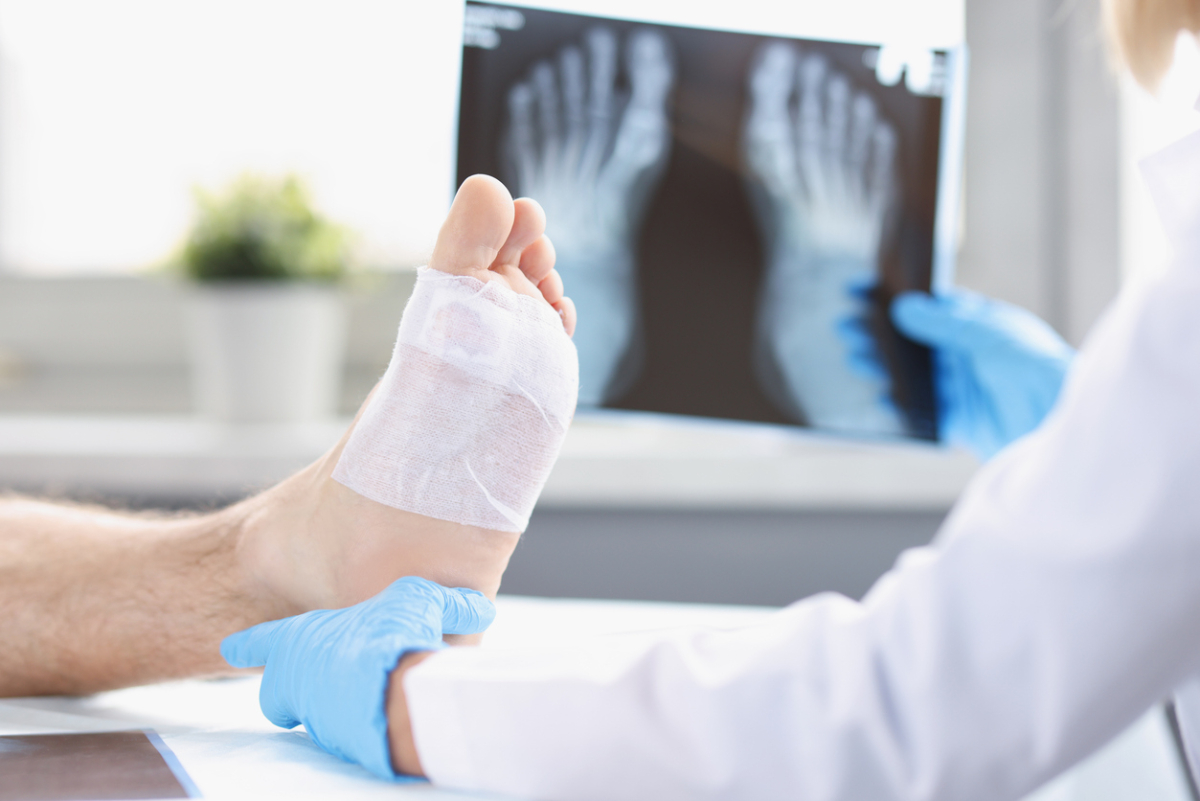Featured image for 5 Most Common Foot Problems